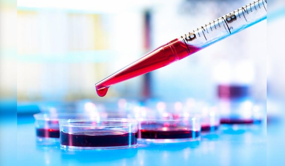 necessary tests before infertility treatment