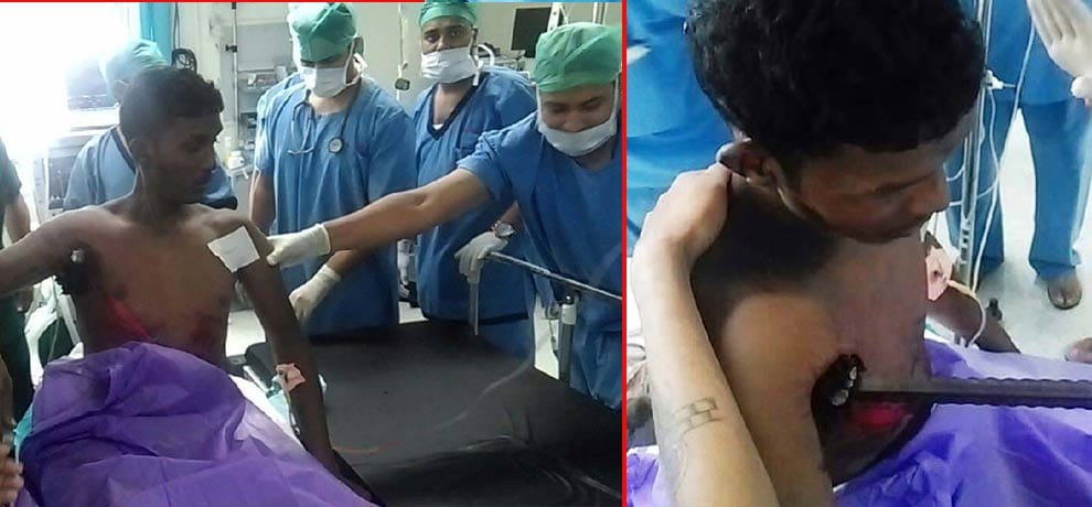 The young man's body was hanging over the back of the Sriye hours, doctors removed by surgery