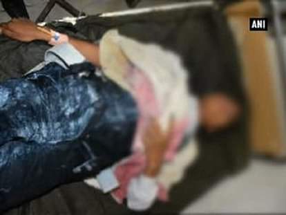 Acid attack on traffic cop leaves her traumatized