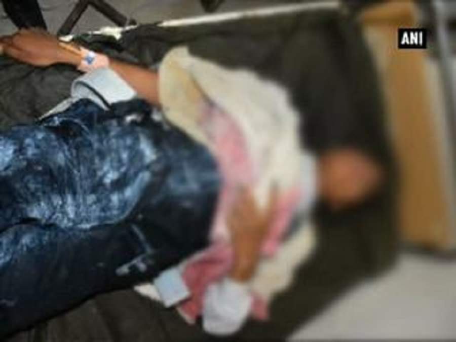 एसिड अटैक