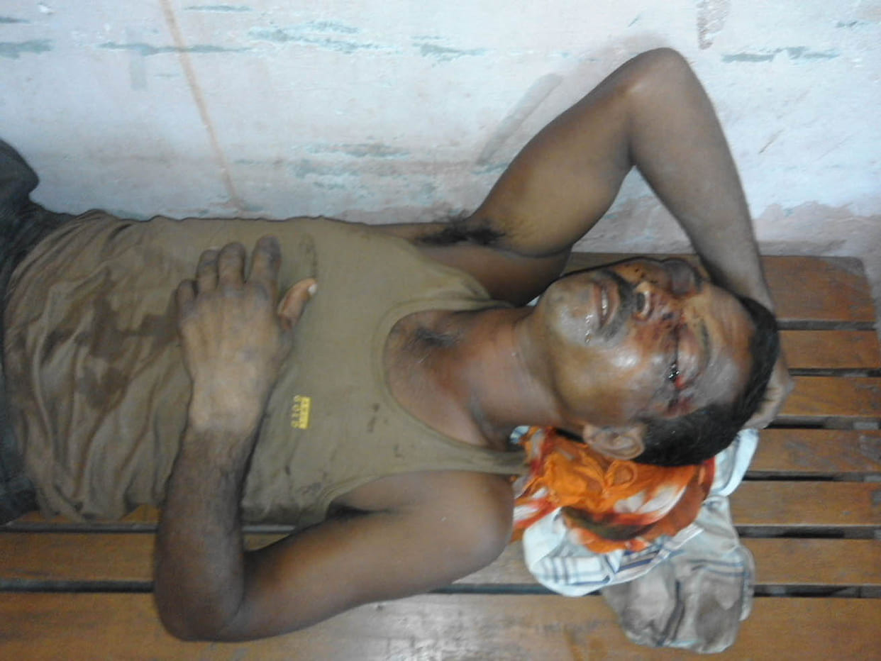 attack on Baghban, eye removed