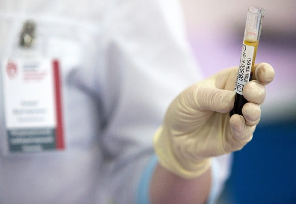 World Aids Day 2019: Unprotected Physical relationship can cause AIDS, Know Aids symptoms Prevention