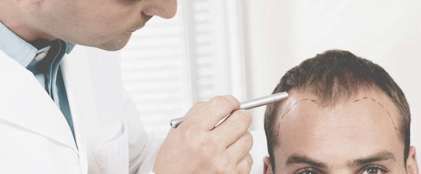 balladness, hair tansplant, hair transplant rules, health news, health tips, chandigarh pgi