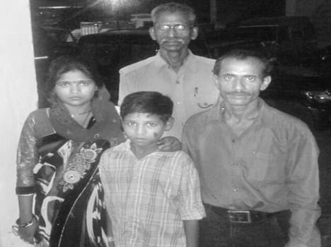 Operation Smile ten year old child recovered