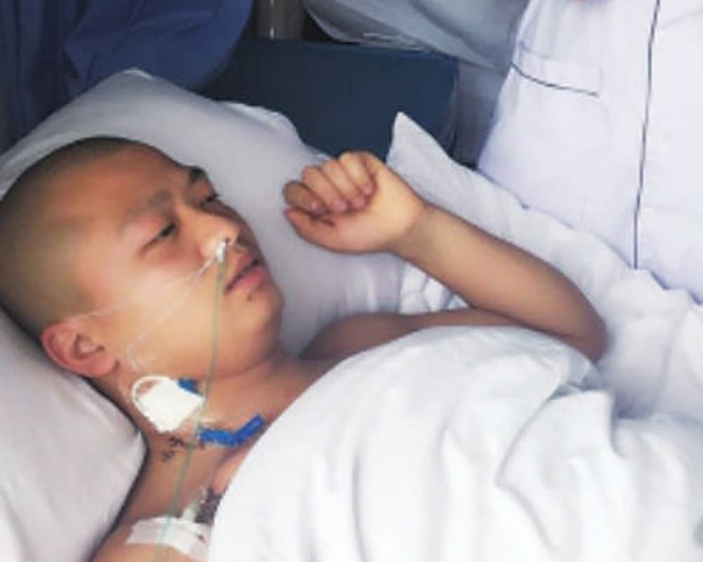 chinese man living with four kidney