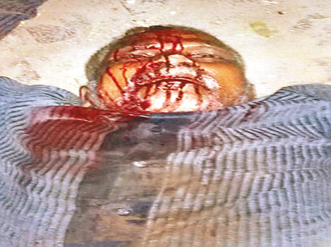 Shopkeeper attacked with sharp weapons at firing