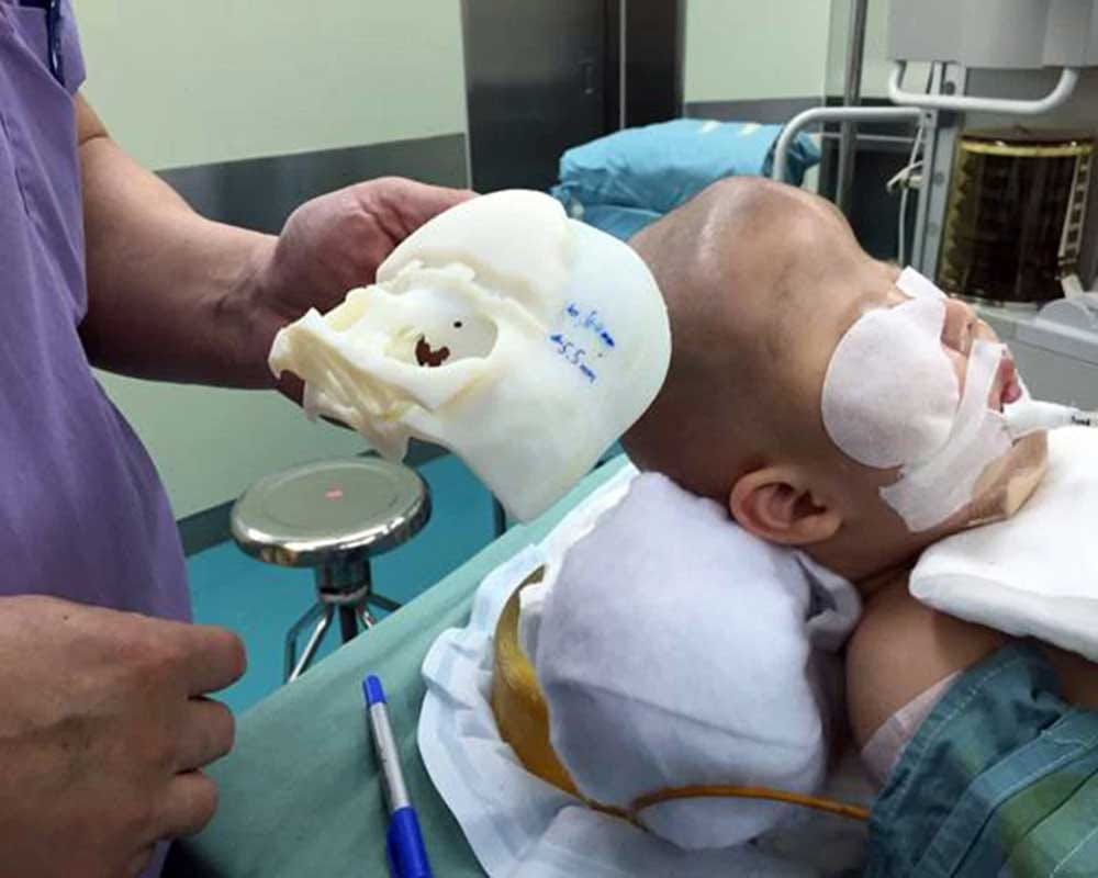 Alien Boy: Boy having rare skull defect