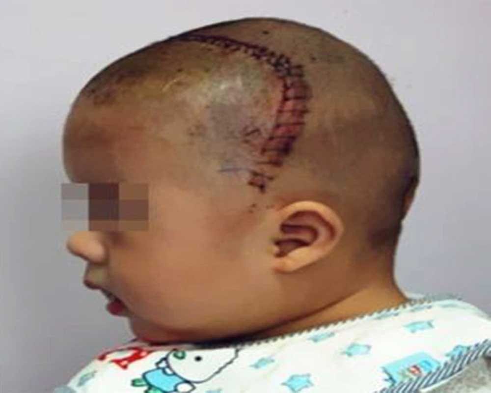 Alien Boy: Boy having rare skull defect