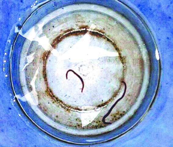 Bugs found in water tank