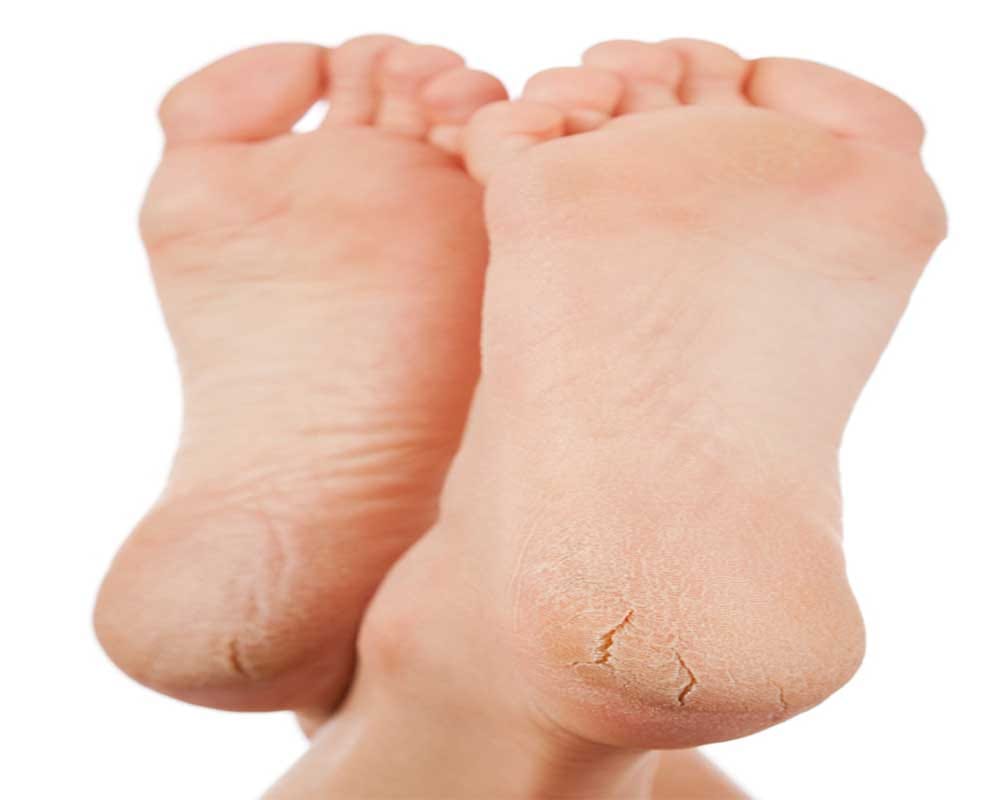 Benefits of Glycerin