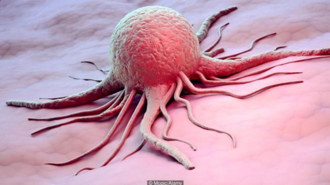  Why is the human cancer victim