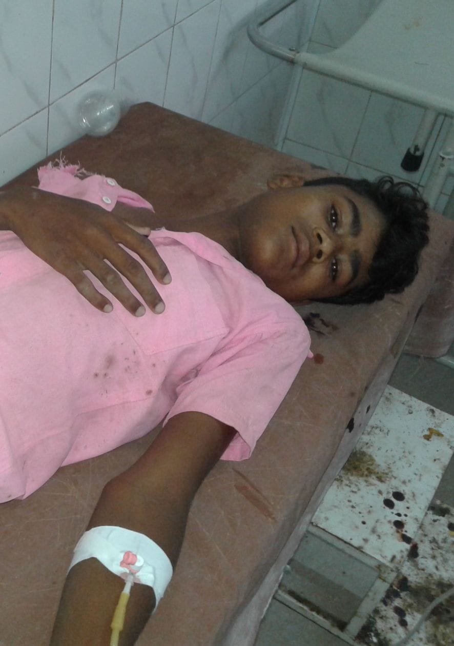 Three bike riders injured in accident