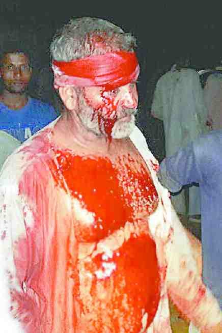 Mulhadha conflict, 18 injured