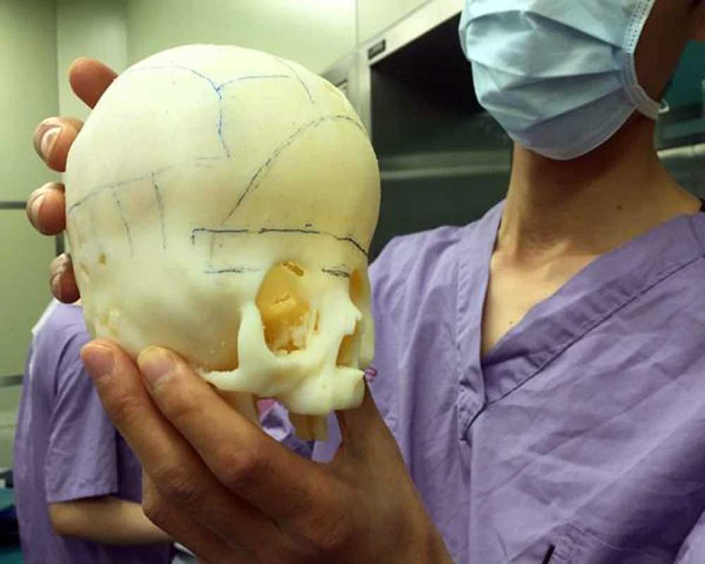 Alien Boy: Boy having rare skull defect