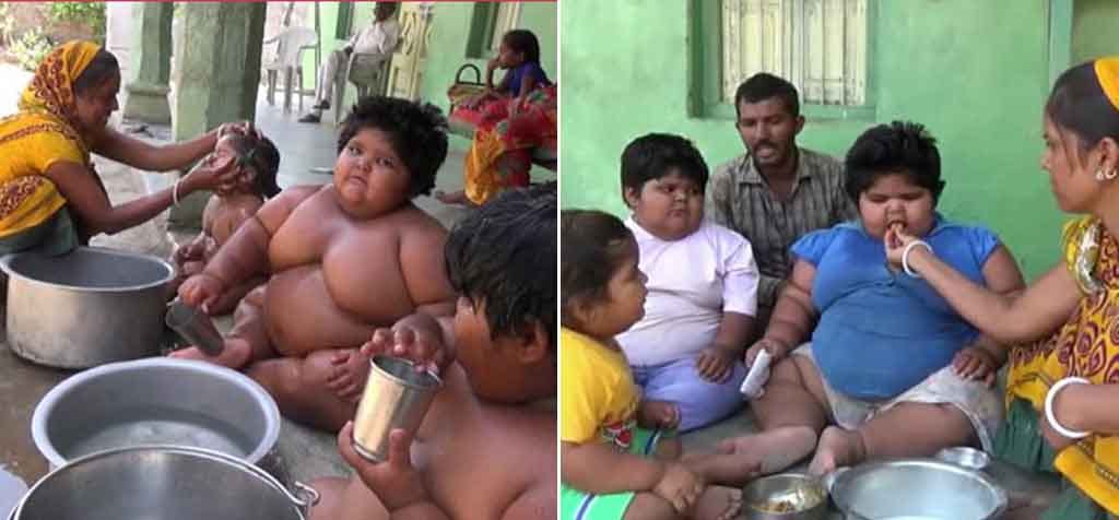 'Sumo kids' who underwent surgery to lose weight are piling on the pounds