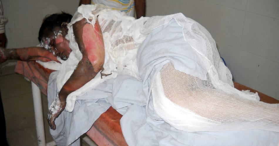 man force sister for sexual relations, man try to burn alive ssiter, lady critically injured