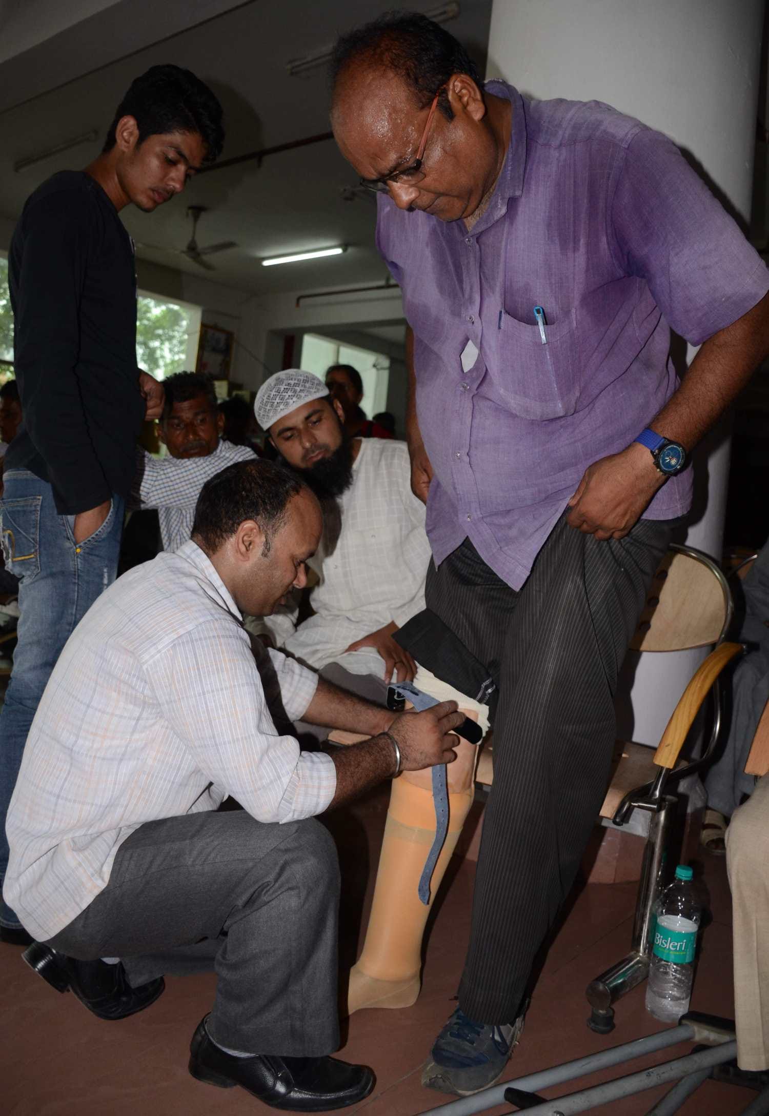 amar ujala and indresh hospital distributed Artificial limbs