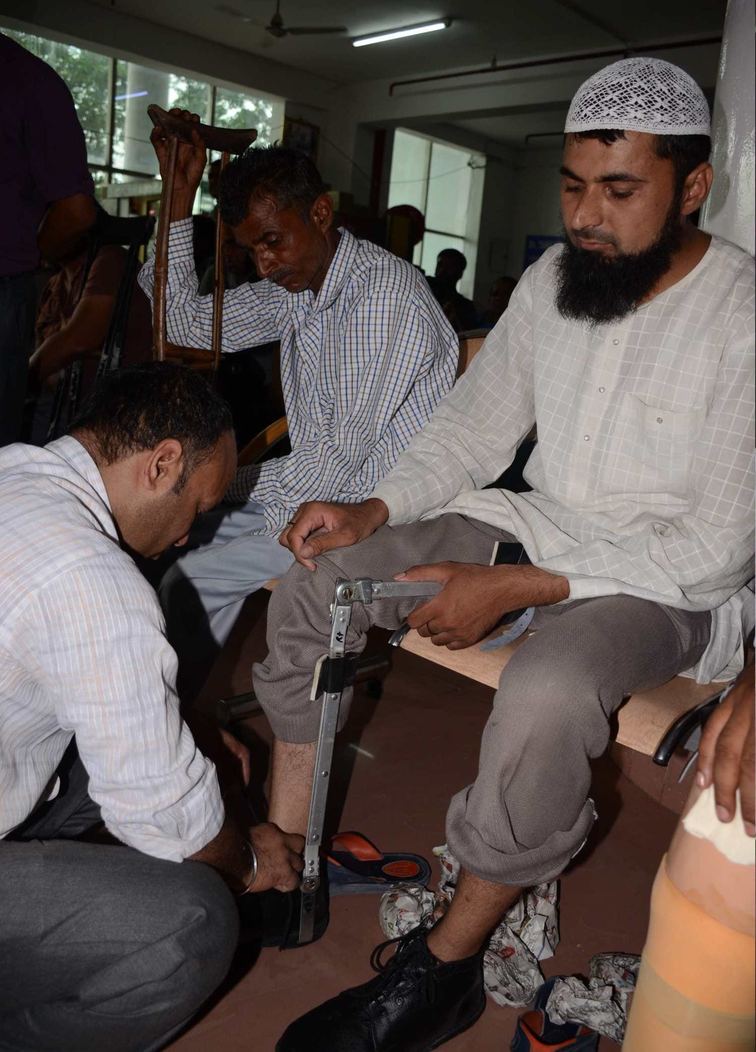 amar ujala and indresh hospital distributed Artificial limbs