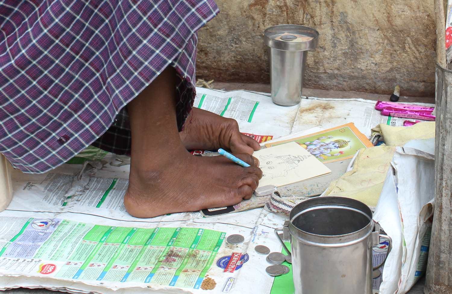 disabled anjana make picture through her leg