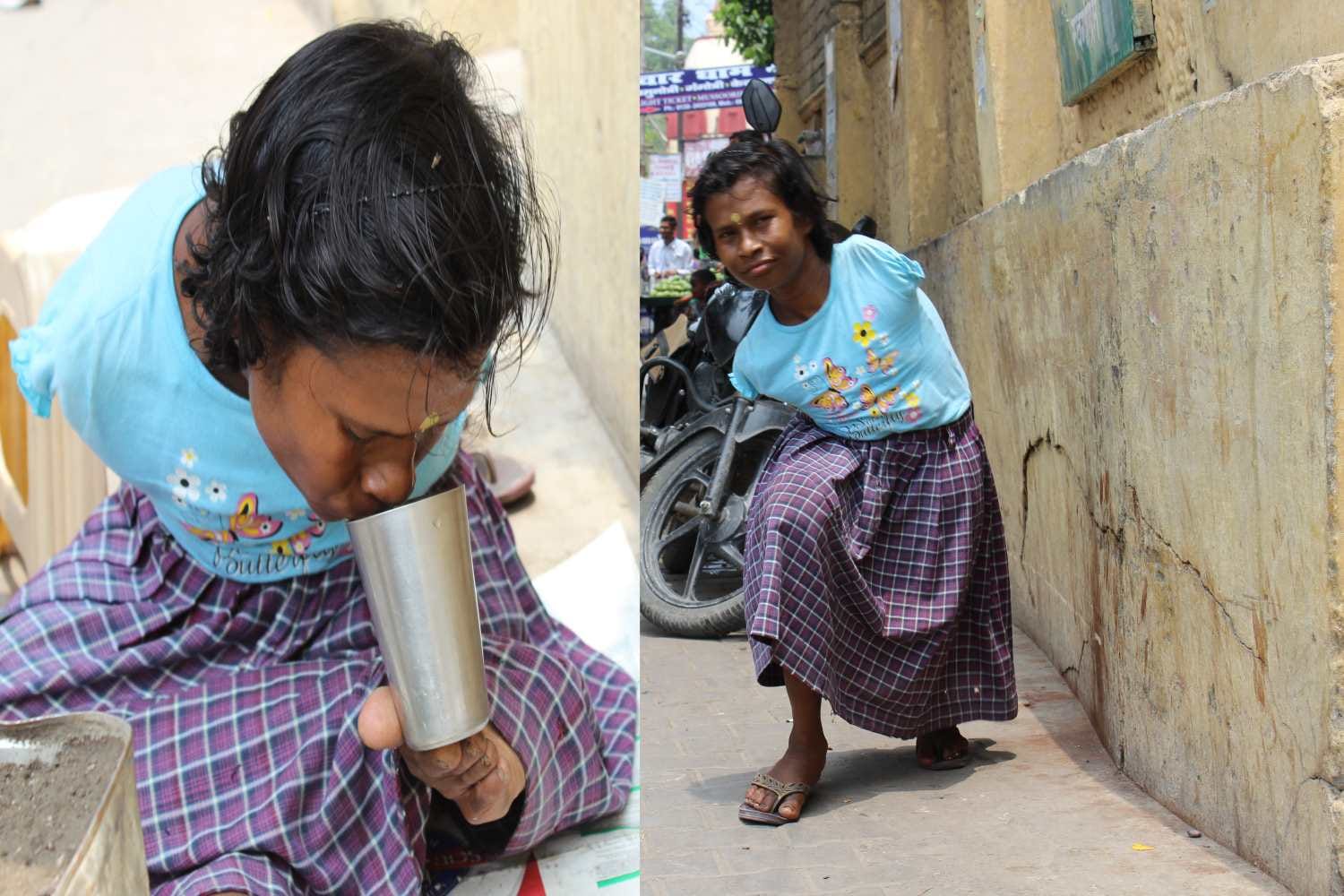 disabled anjana make picture through her leg