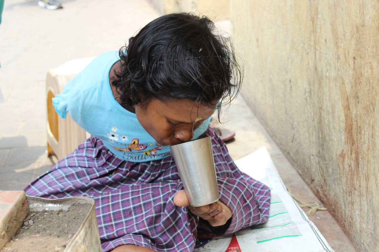 disabled anjana make picture through her leg