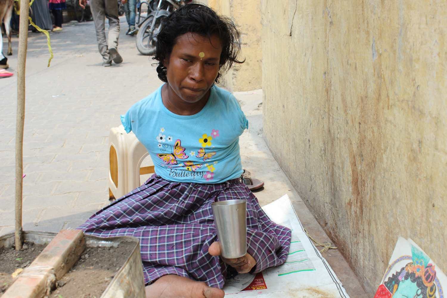 disabled anjana make picture through her leg
