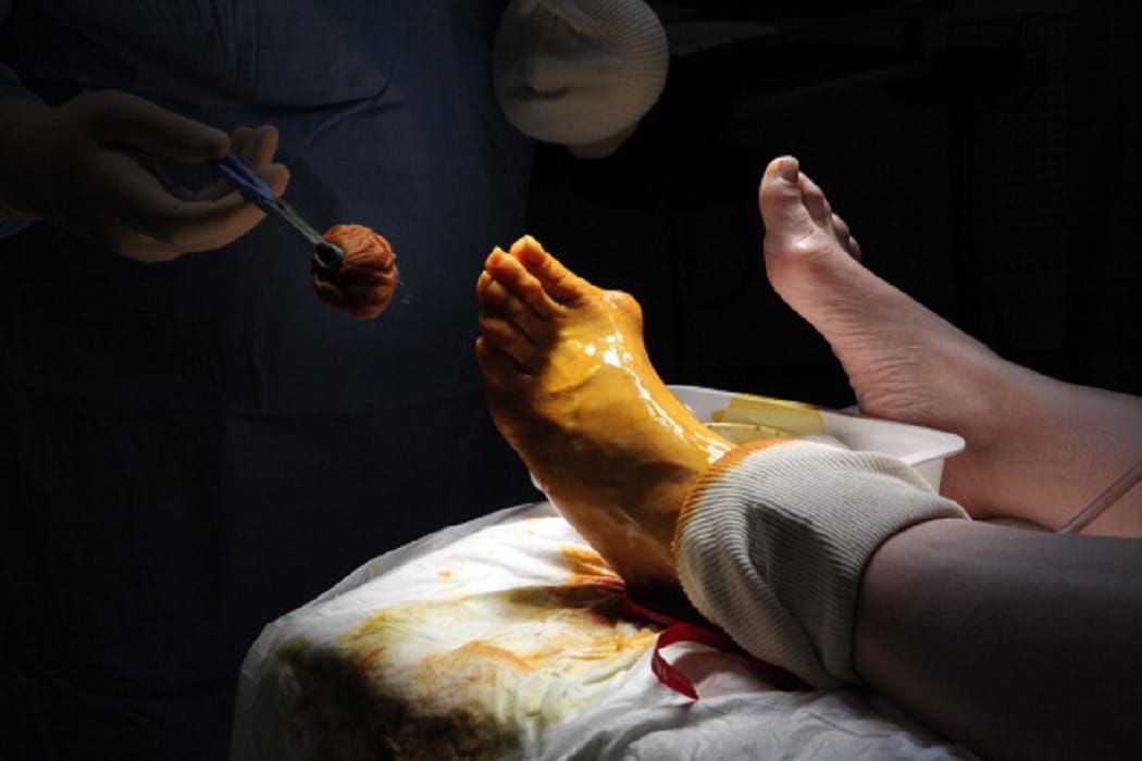 Doctors will made a new world record after doing 5,000 operations in just three days