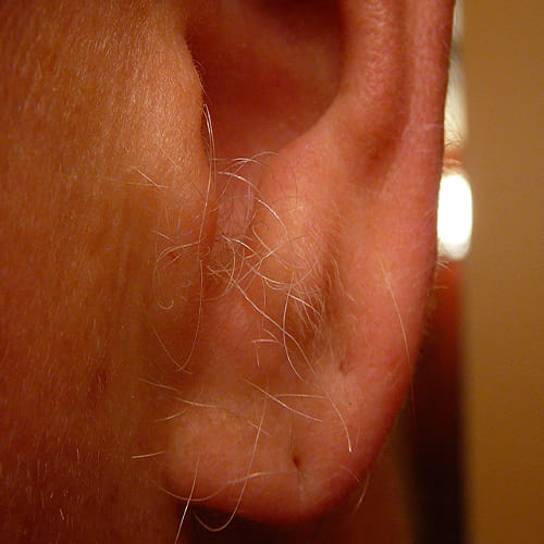 Hair In Ear Is A Warning of heart attack
