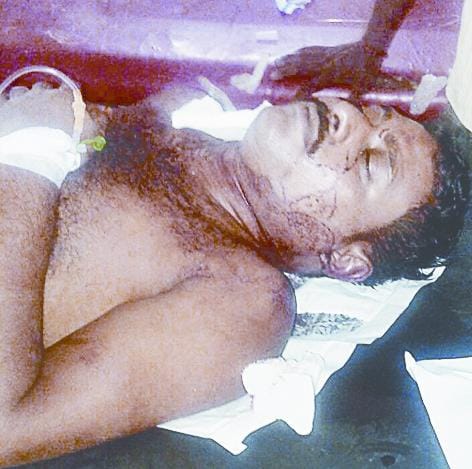 shooters try to kill truck driver for robbery at fourlane