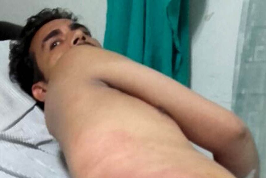 After the operation to save lives in the district hospital had heavy