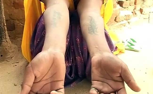 Rajasthan: Yong woman tattooed with abuse