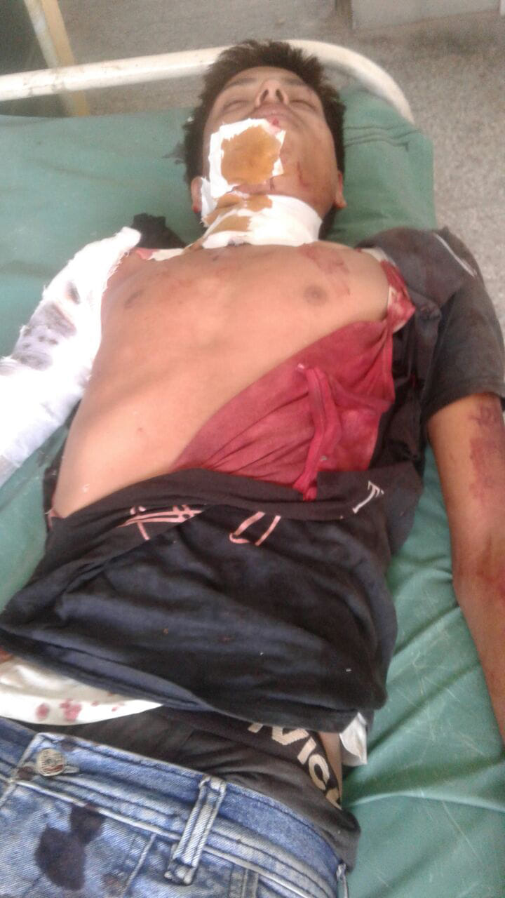 Youth in old enmity Shot and wounded