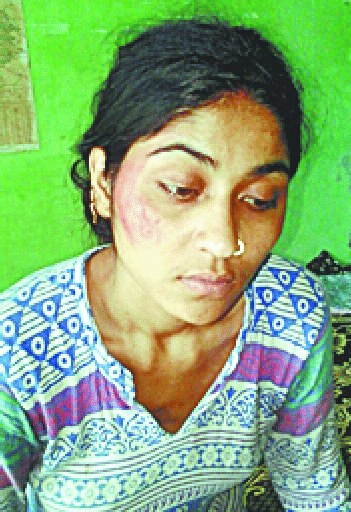 Attempt to kill daughter in law for dowry