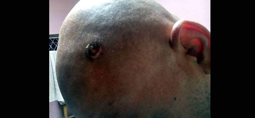  in dispute cut head by teeth, had tonsured head