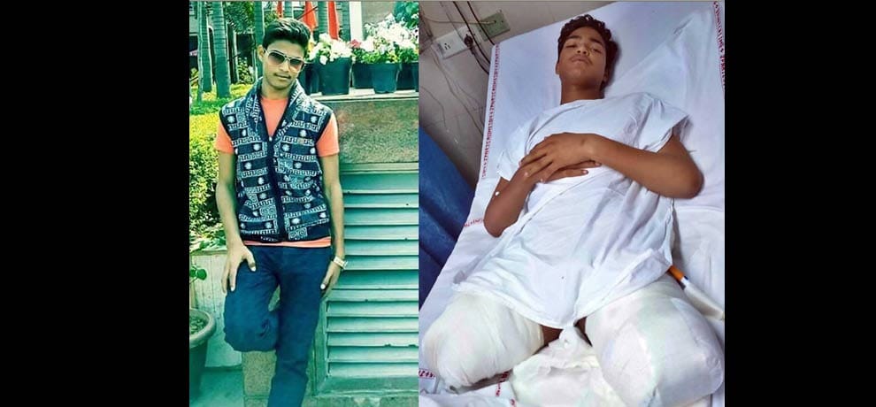 firing on Father and son, 16 years Rajan legs injured 