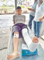 Candidate broken leg fracture on the road, Kurukshetra