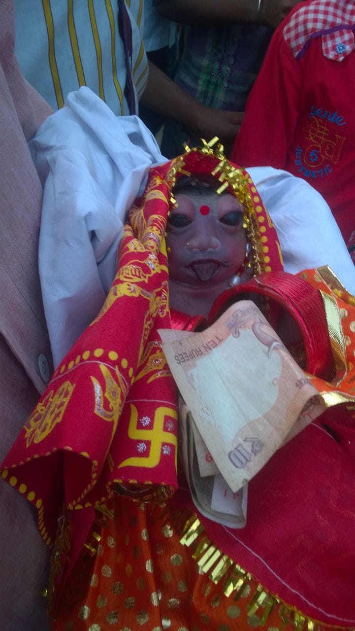 strange baby born in barabanki