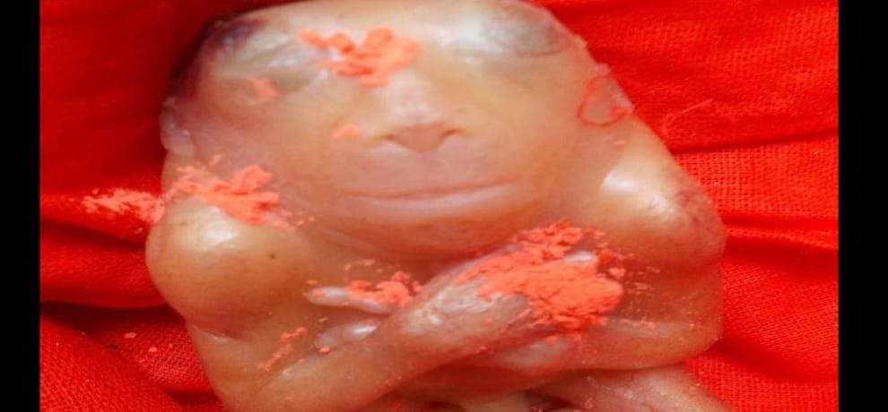 strange baby born in barabanki