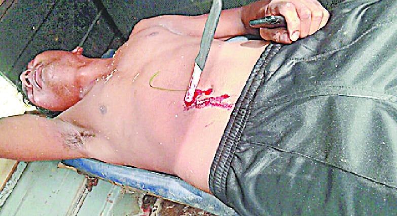 Audacity: A young man stabbed in the stomach