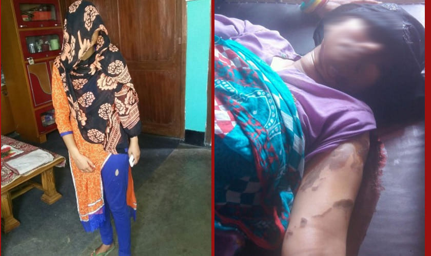 acid attack on three ladies