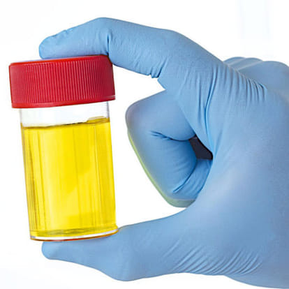 this man drink his urine