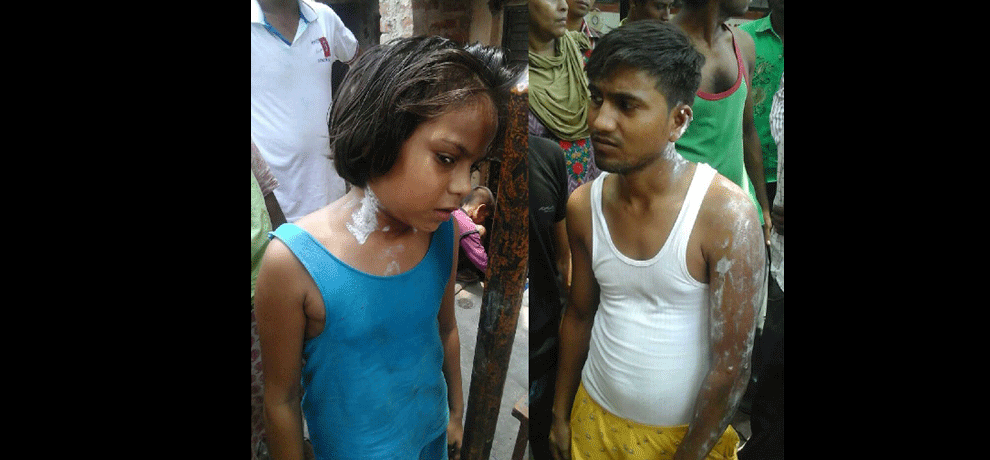 Incident:  death of the young man because of high tension line, including child three scorched