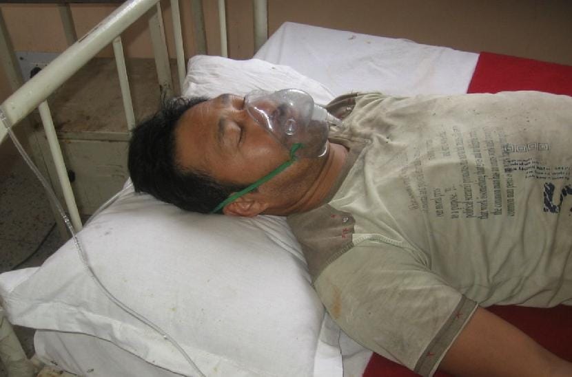 electricity cable brunt in project, four injured