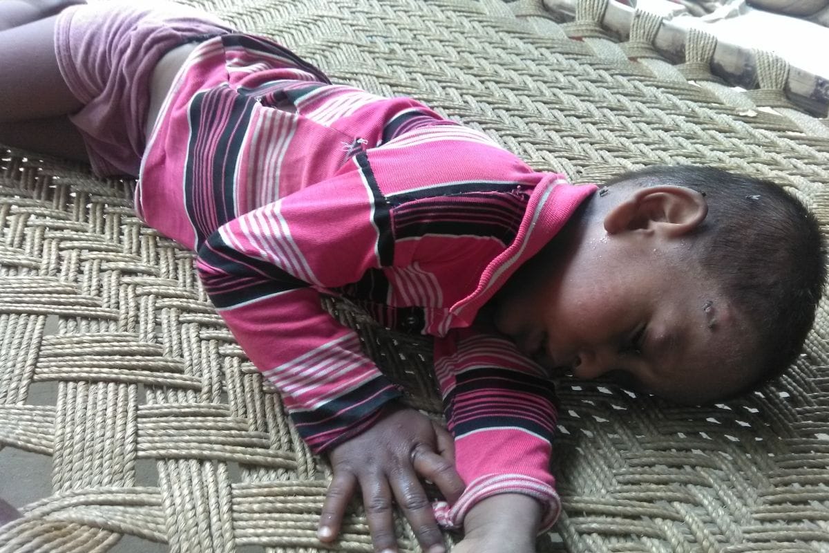 Centre deploys high-level team to Mumbai to manage outbreak of measles