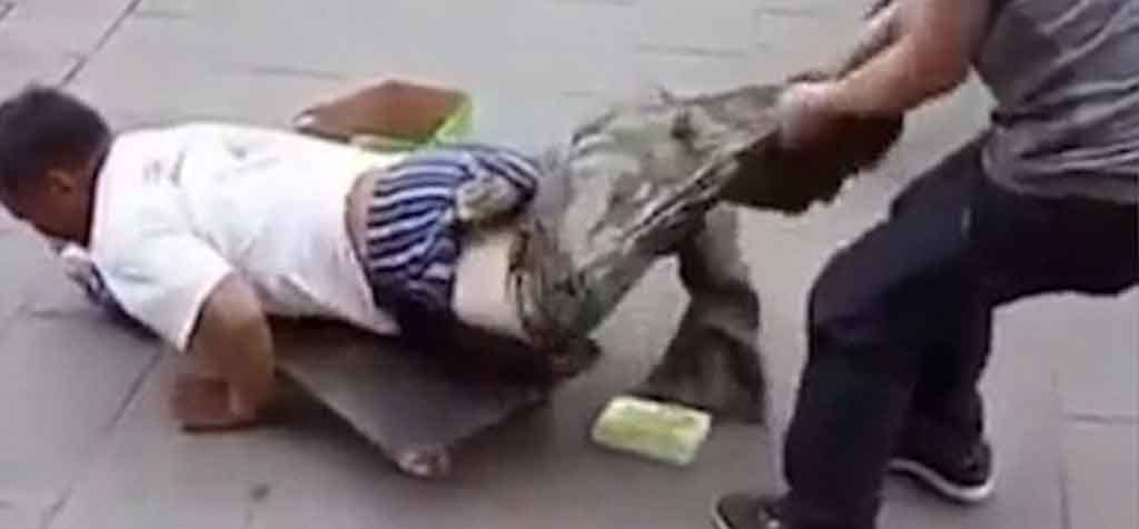 Beggar busted faking his disability after a passerby dragged off his trousers