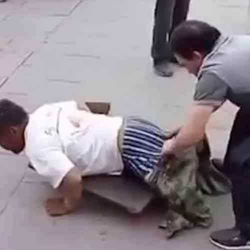 Beggar busted faking his disability after a passerby dragged off his trousers