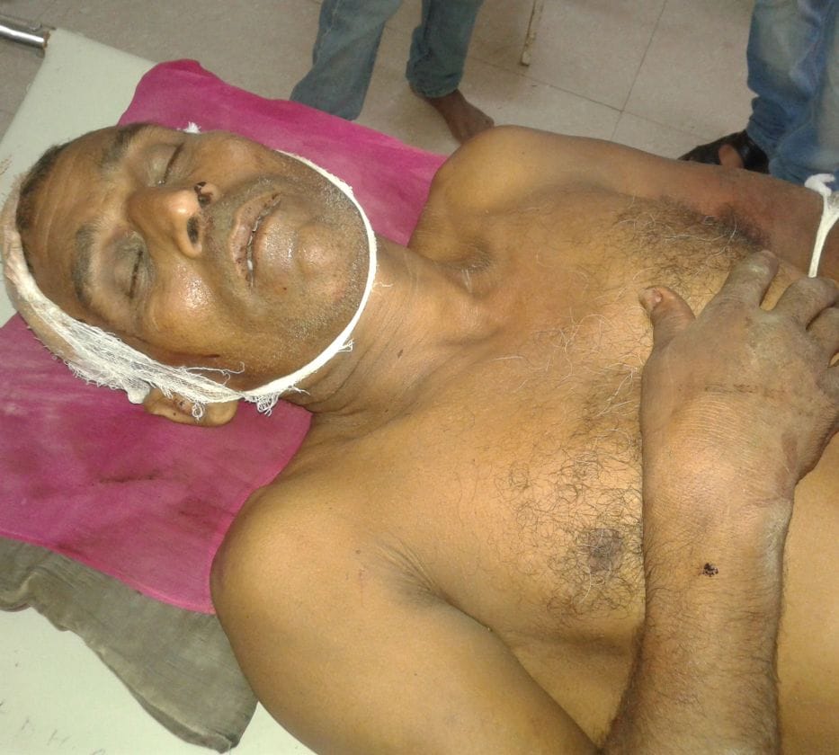 Five people injured in an accidents