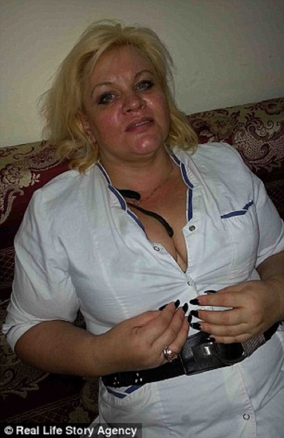 woman claims she lost weight leeches suck her blood