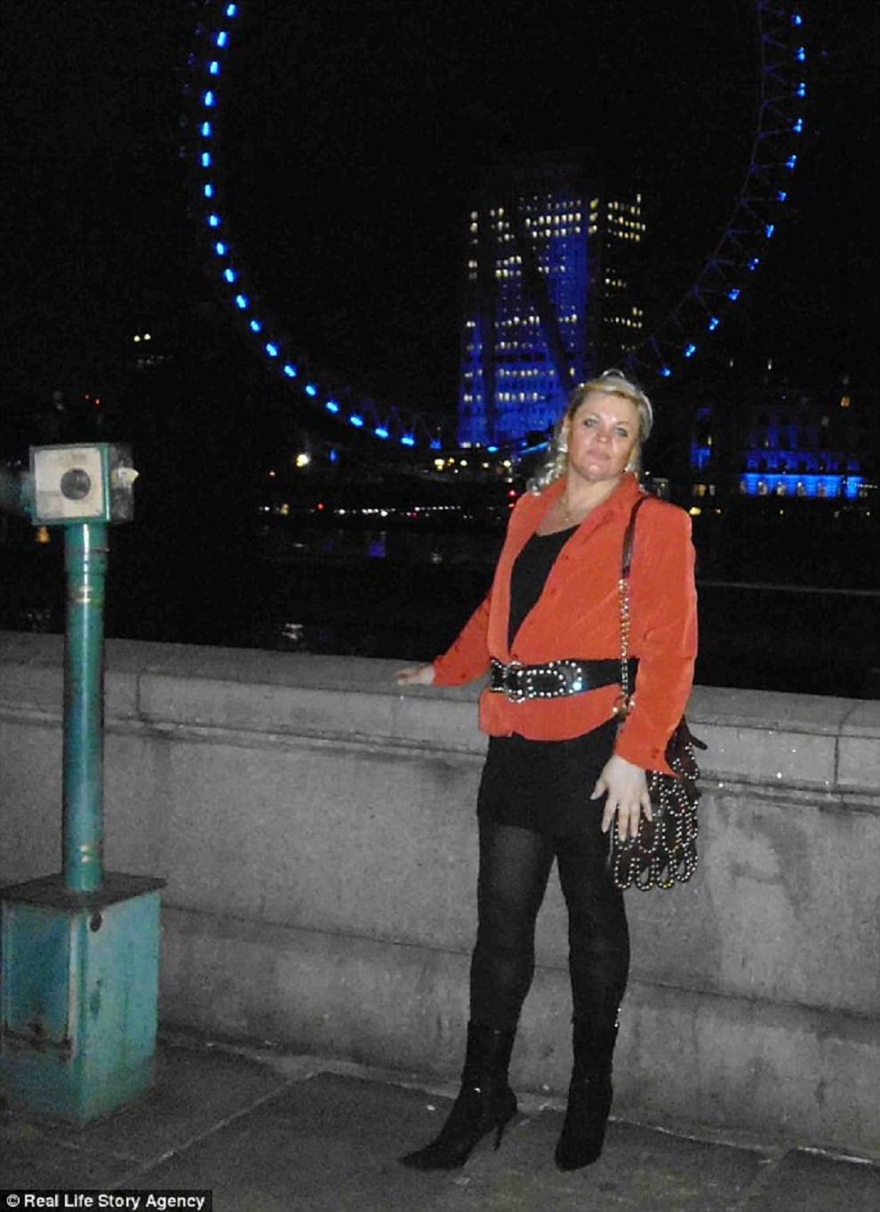 woman claims she lost weight leeches suck her blood