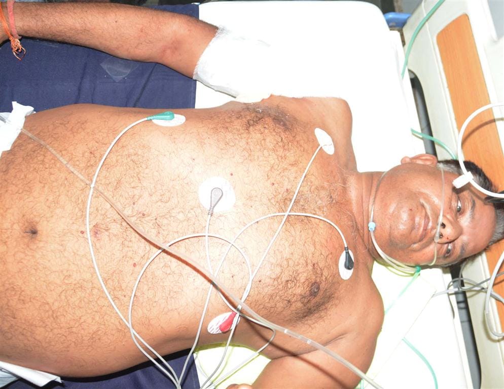 Former BJP MLA Munish Gaur shot , wounded